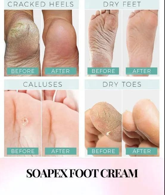 Nourishing Foot Cream - 1 Pcs for Soft and Smooth Feet